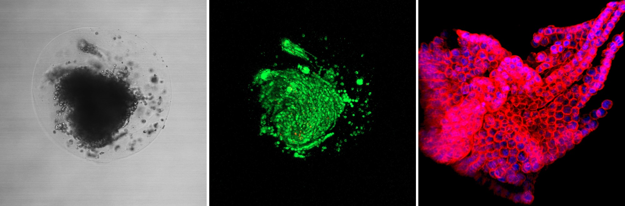 Hydrogel micro lymph nodes for 