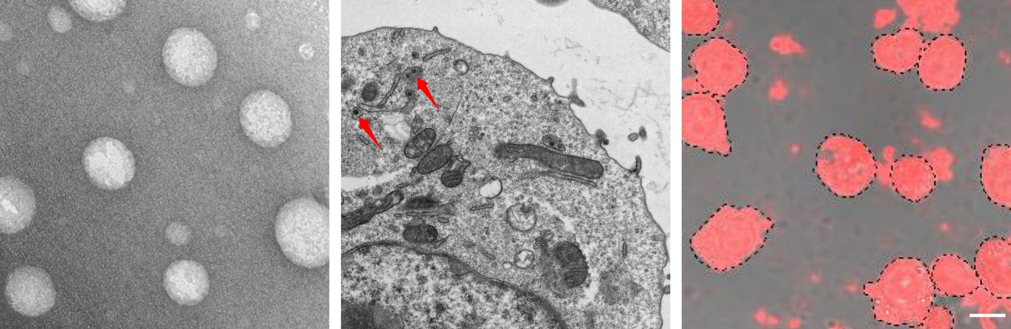 Zombie Macrophage-Encapsulated Responsive Nanoparticles