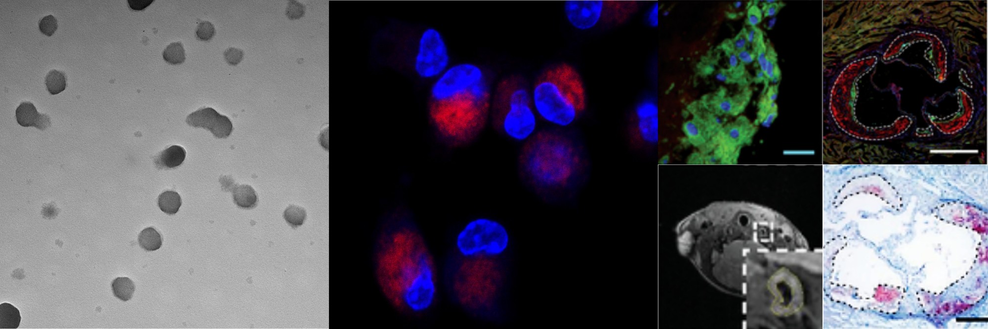 Nanoshuttles Simulating Phagocytosis of Apoptotic Cells